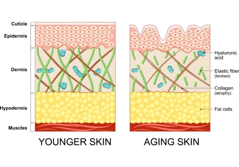 Facial Changes As We Age - Aesthetic Solutions