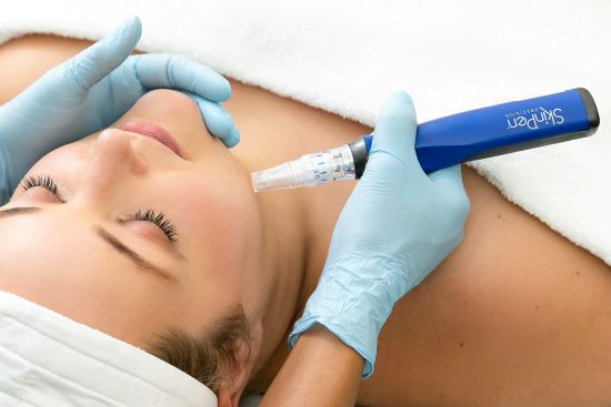 microneedling with skinpen
